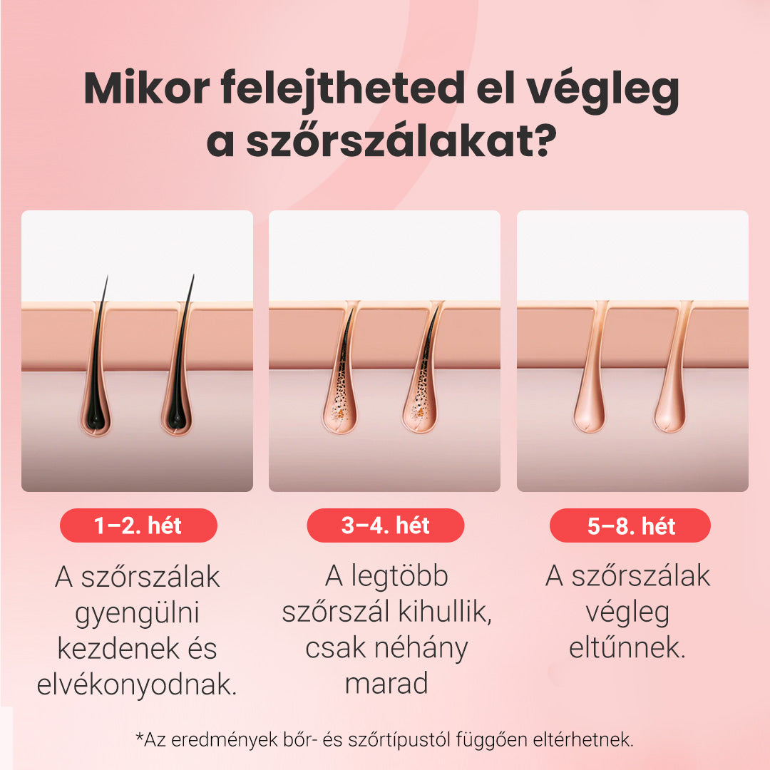 „Hilda” IPL fotoepilátor + „Hummi” hajszárító