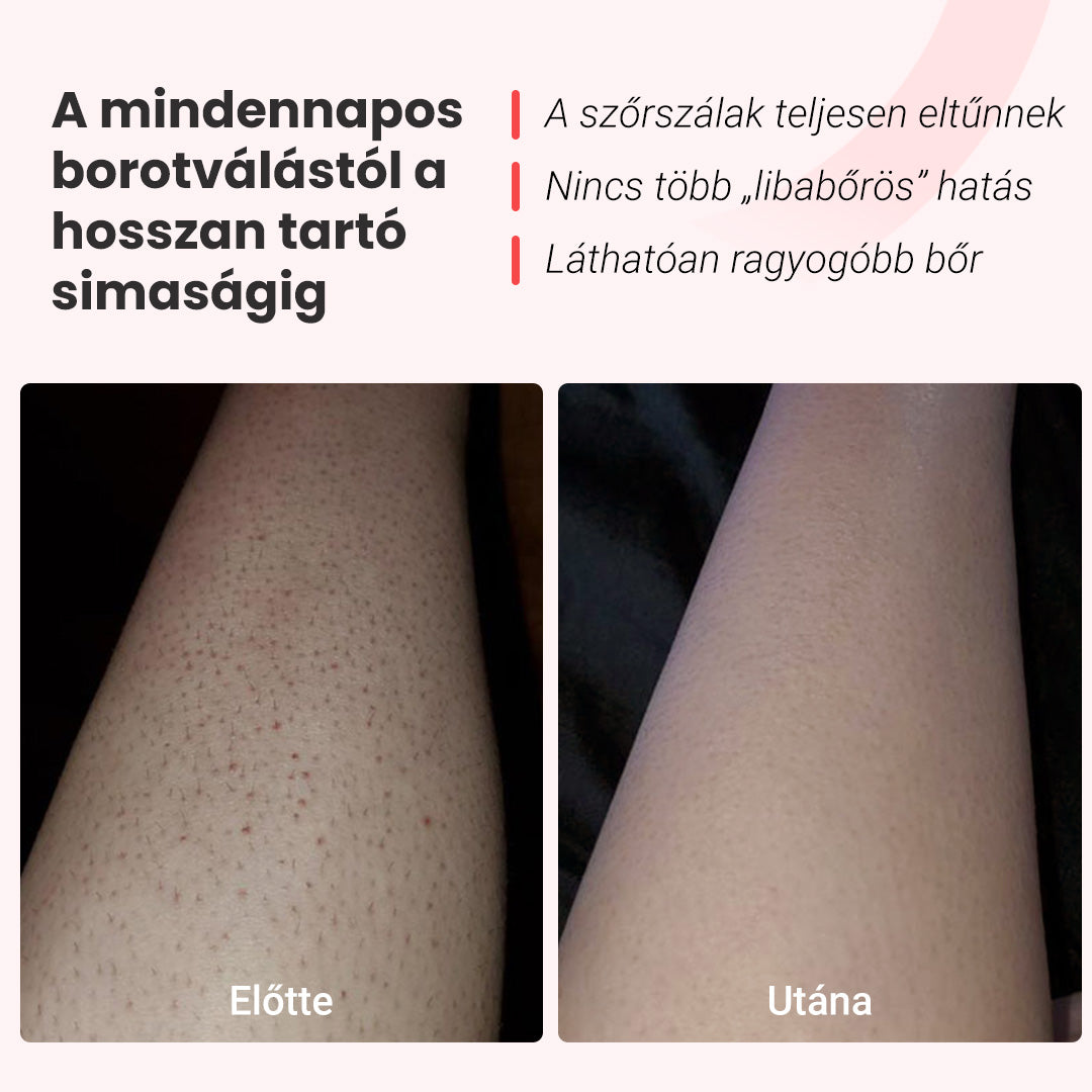 „Hilda” IPL fotoepilátor + „Hummi” hajszárító
